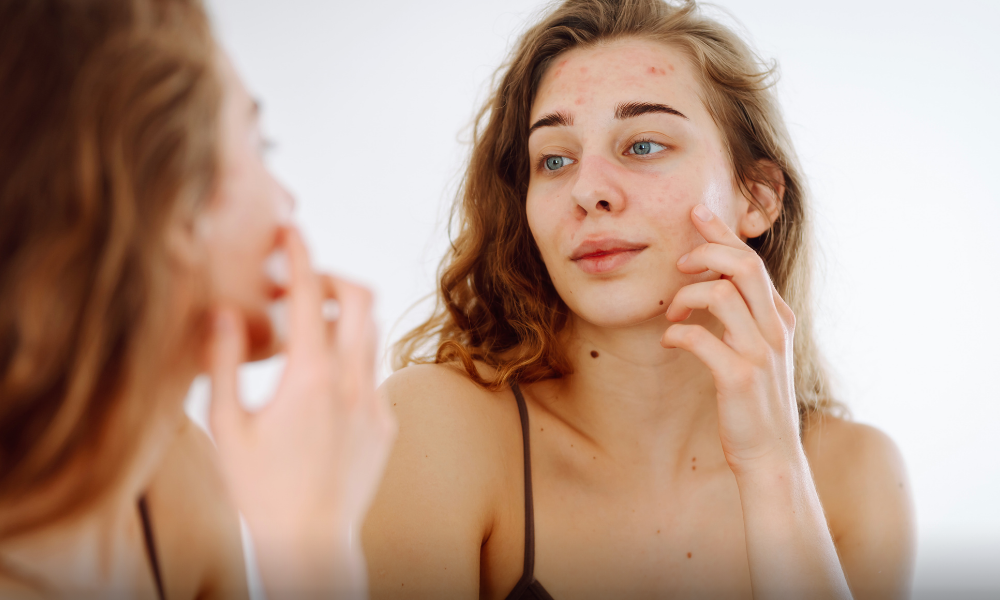 The Dry Skin Trap