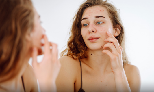 The Dry Skin Trap
